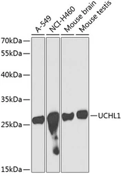 Anti-PGP9.5 antibody used in Western Blot (WB). GTX32782
