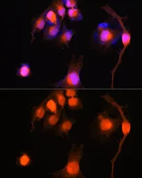 Anti-PGP9.5 antibody used in Immunocytochemistry/ Immunofluorescence (ICC/IF). GTX32782