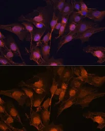 Anti-PGP9.5 antibody used in Immunocytochemistry/ Immunofluorescence (ICC/IF). GTX32782