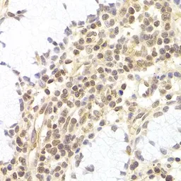 Anti-PHC1 antibody used in IHC (Paraffin sections) (IHC-P). GTX32784