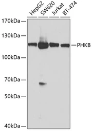 Anti-PHKB antibody used in Western Blot (WB). GTX32790