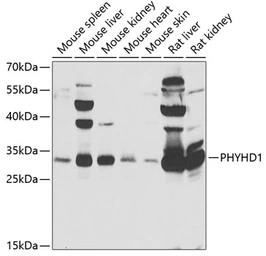 Anti-PHYHD1 antibody used in Western Blot (WB). GTX32791