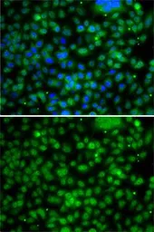 Anti-PHYHD1 antibody used in Immunocytochemistry/ Immunofluorescence (ICC/IF). GTX32791