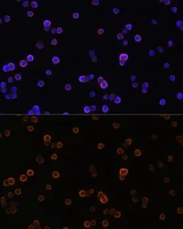 Anti-PLCG2 antibody used in Immunocytochemistry/ Immunofluorescence (ICC/IF). GTX32793