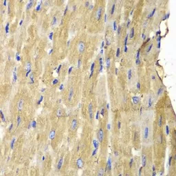 Anti-PLCG2 antibody used in IHC (Paraffin sections) (IHC-P). GTX32793