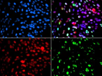 Anti-POLD3 antibody used in Immunocytochemistry/ Immunofluorescence (ICC/IF). GTX32795