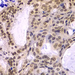 Anti-POLD3 antibody used in IHC (Paraffin sections) (IHC-P). GTX32795