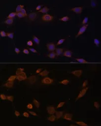 Anti-POR antibody used in Immunocytochemistry/ Immunofluorescence (ICC/IF). GTX32801