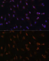 Anti-POR antibody used in Immunocytochemistry/ Immunofluorescence (ICC/IF). GTX32801