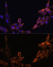 Anti-POR antibody used in Immunocytochemistry/ Immunofluorescence (ICC/IF). GTX32801