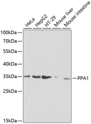 Anti-PPA1 antibody used in Western Blot (WB). GTX32802