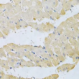 Anti-PPA1 antibody used in IHC (Paraffin sections) (IHC-P). GTX32802