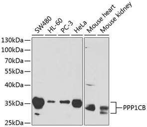 Anti-PPP1CB antibody used in Western Blot (WB). GTX32804