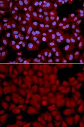 Anti-PPP1CB antibody used in Immunocytochemistry/ Immunofluorescence (ICC/IF). GTX32804
