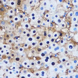 Anti-PPP1CB antibody used in IHC (Paraffin sections) (IHC-P). GTX32804