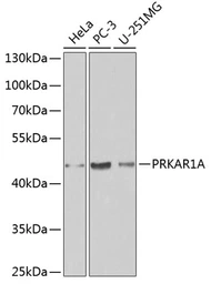 Anti-PKA I alpha reg antibody used in Western Blot (WB). GTX32809
