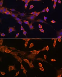 Anti-PKA I alpha reg antibody used in Immunocytochemistry/ Immunofluorescence (ICC/IF). GTX32809