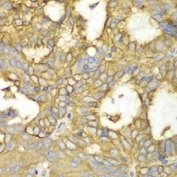 Anti-PKA I alpha reg antibody used in IHC (Paraffin sections) (IHC-P). GTX32809