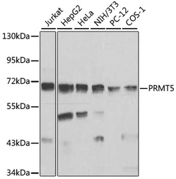 Anti-PRMT5 antibody used in Western Blot (WB). GTX32810
