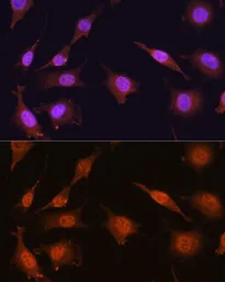 Anti-PRMT5 antibody used in Immunocytochemistry/ Immunofluorescence (ICC/IF). GTX32810