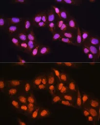 Anti-PRMT5 antibody used in Immunocytochemistry/ Immunofluorescence (ICC/IF). GTX32810