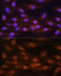 Anti-PRMT5 antibody used in Immunocytochemistry/ Immunofluorescence (ICC/IF). GTX32810