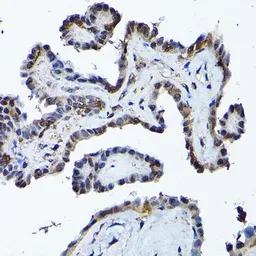 Anti-PRMT5 antibody used in IHC (Paraffin sections) (IHC-P). GTX32810
