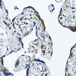 Anti-PRMT5 antibody used in IHC (Paraffin sections) (IHC-P). GTX32810