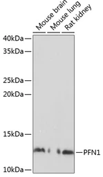 Anti-Profilin 1 antibody used in Western Blot (WB). GTX32811