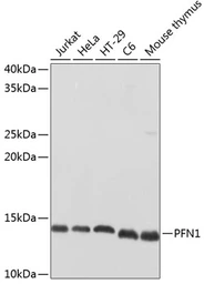 Anti-Profilin 1 antibody used in Western Blot (WB). GTX32811