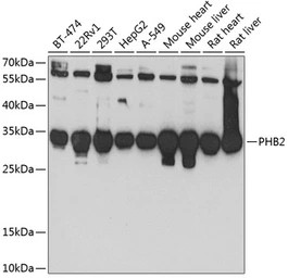 Anti-Prohibitin 2 antibody used in Western Blot (WB). GTX32812