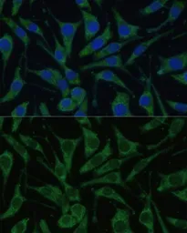 Anti-Prohibitin 2 antibody used in Immunocytochemistry/ Immunofluorescence (ICC/IF). GTX32812