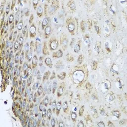 Anti-Prohibitin 2 antibody used in IHC (Paraffin sections) (IHC-P). GTX32812