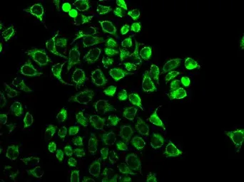 Anti-Prolactin antibody used in Immunocytochemistry/ Immunofluorescence (ICC/IF). GTX32813