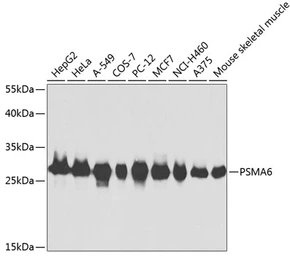 Anti-PSMA6 antibody used in Western Blot (WB). GTX32815