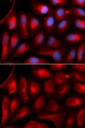 Anti-PSMA5 antibody used in Immunocytochemistry/ Immunofluorescence (ICC/IF). GTX32817