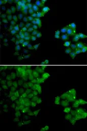 Anti-PSMB10 antibody used in Immunocytochemistry/ Immunofluorescence (ICC/IF). GTX32818