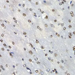 Anti-PSMB10 antibody used in IHC (Paraffin sections) (IHC-P). GTX32818