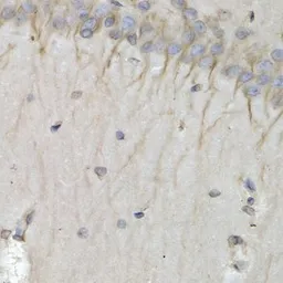 Anti-PSMB10 antibody used in IHC (Paraffin sections) (IHC-P). GTX32818