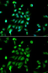 Anti-PSMC5 antibody used in Immunocytochemistry/ Immunofluorescence (ICC/IF). GTX32819