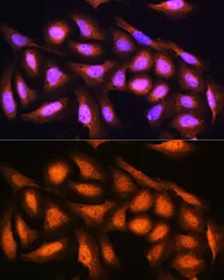 Anti-PSMD4 antibody used in Immunocytochemistry/ Immunofluorescence (ICC/IF). GTX32821