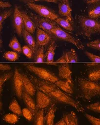 Anti-PSMD4 antibody used in Immunocytochemistry/ Immunofluorescence (ICC/IF). GTX32821