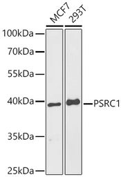 Anti-PSRC1 antibody used in Western Blot (WB). GTX32823