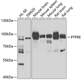 Anti-PTPRE antibody used in Western Blot (WB). GTX32824