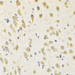 Anti-PTPRE antibody used in IHC (Paraffin sections) (IHC-P). GTX32824