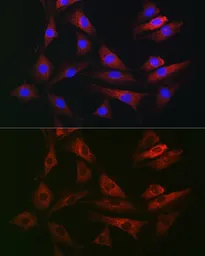 Anti-RAB1B antibody used in Immunocytochemistry/ Immunofluorescence (ICC/IF). GTX32825