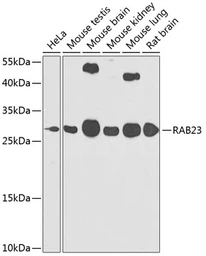 Anti-RAB23 antibody used in Western Blot (WB). GTX32826