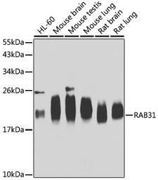 Anti-RAB31 antibody used in Western Blot (WB). GTX32827