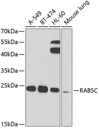 Anti-RAB5C antibody used in Western Blot (WB). GTX32828