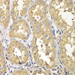 Anti-RAB5C antibody used in IHC (Paraffin sections) (IHC-P). GTX32828